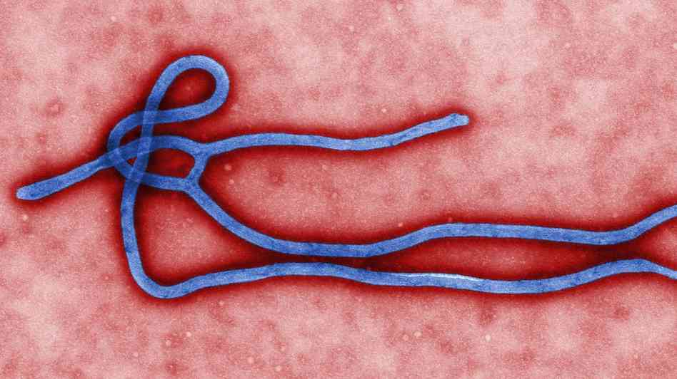 Ebola-Virus